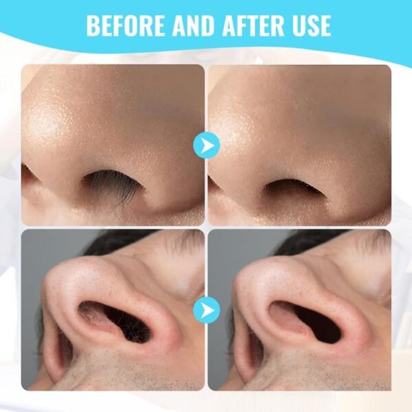 PSKZNSZ 5Pcs 2-in-1 Nasal Hair Cutter, 360° Rotating Nose Hair Trimmer for Women Men, 2024 New Double Sided Nose Hair Knife, Portable Nostril Hair Remover Tool - Image 4