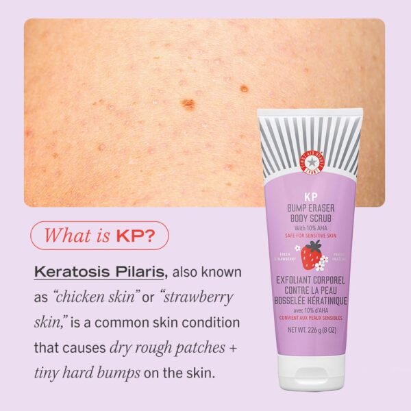 First Aid Beauty - KP Bump Eraser Body Scrub with 10% AHA, Keratosis Pilaris Exfoliater with Glycolic and Lactic acids, Helps Reduce Chicken Skin Bumps, Safe for Sensitive Skin, Strawberry Scent, 8 oz - Image 9