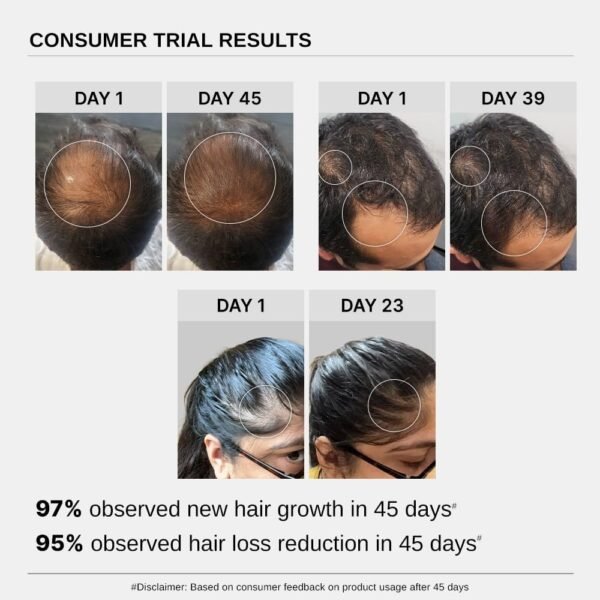 Bare Anatomy Advanced Hair Growth Serum | 3% Redensyl + 4% Anagain + 3% Baicapil + 1% Capilia Longa, Rosemary, Biotin & Rice Extract | Hair growth & Hair fall control serum for Women & Men | 30mL - Image 6