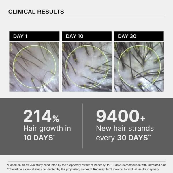 Bare Anatomy Advanced Hair Growth Serum | 3% Redensyl + 4% Anagain + 3% Baicapil + 1% Capilia Longa, Rosemary, Biotin & Rice Extract | Hair growth & Hair fall control serum for Women & Men | 30mL - Image 5