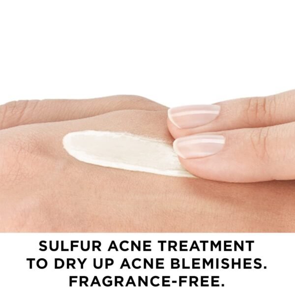 Vichy Normaderm S.O.S Acne Rescue Spot Corrector, 10% Sulfur & Glycolic Acid & Niacinamide, Blackhead Remover & Acne Spot Treatment For Face, Helps Clear & Prevent, Paraben & Oil Free - Image 4