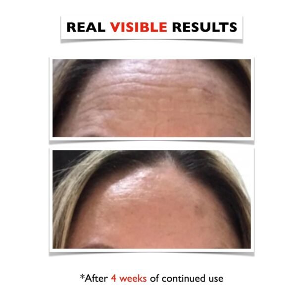 Big 2 Fl Oz. Vitamin C Face Serum. Anti Aging Dark Spot Remover Facial Serum. All-in-One Brightening Vitamin C, Niacinamide, Hyaluronic Acid & Vit E Skin Care Serum for Eye Area, Fine Lines & Wrinkles - Image 6