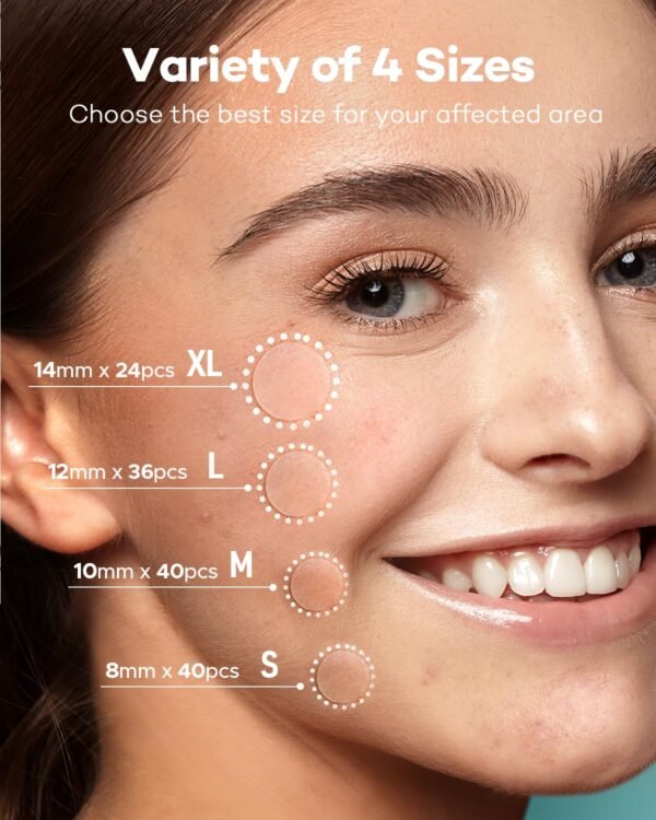 Acne Patch Pimple Patch, 4 Sizes 140 Patches Acne Absorbing Cover Patch, Hydrocolloid Invisible Acne Patches For Face Zit Patch Acne Dots Tea Tree, Calendula Oil - Image 3