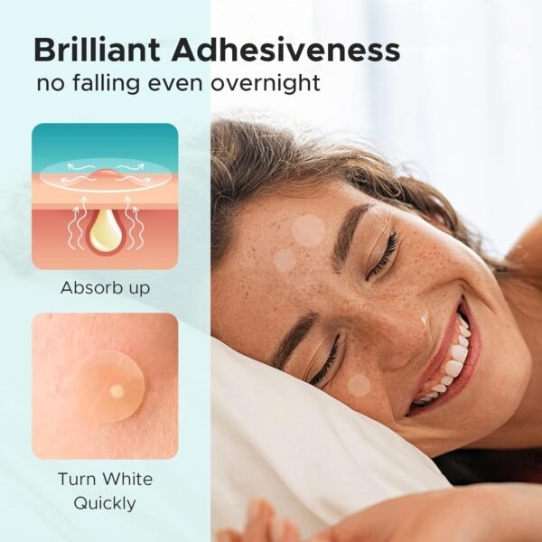 Acne Patch Pimple Patch, 4 Sizes 140 Patches Acne Absorbing Cover Patch, Hydrocolloid Invisible Acne Patches For Face Zit Patch Acne Dots Tea Tree, Calendula Oil - Image 5
