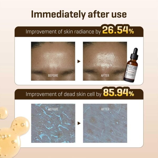 SOME BY MI Galactomyces Pure Vitamin C Glow Serum - 1.01Oz, 30ml - Korean Vitamin C Face Serum for Glow Glass Skin - Dark Spot Correcting Serum with Skin Texture and Elasticity Care - Korean Skin Care - Image 8