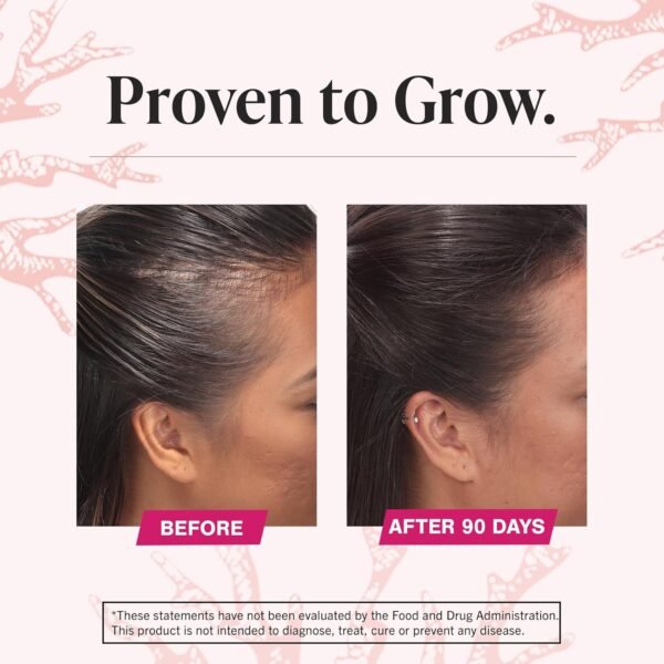 Viviscal Hair Growth Supplements for Women, Clinically Proven Hair Growth Product with Proprietary Collagen Complex, Results of Thicker, Fuller Hair Nourish Hair Loss, 180 Tablets - 3 Month Supply - Image 7