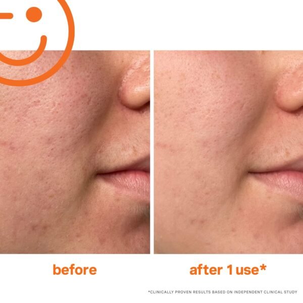 Kate Somerville ExfoliKate Intensive Exfoliating Treatment – Salicylic Acid and Lactic Acid Super Facial Scrub Improves Texture and Pores - Image 7
