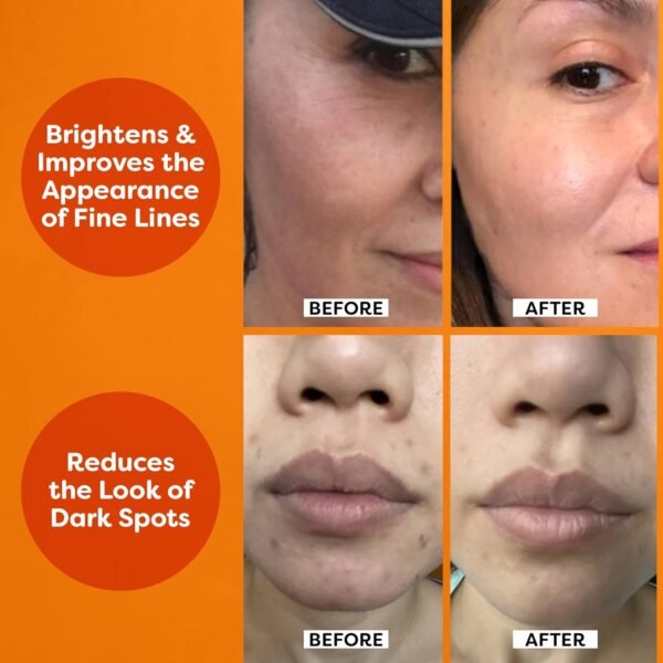 TruSkin Vitamin C Serum – Anti Aging Facial Serum with Vitamin C, Hyaluronic Acid, Vitamin E – Brightening Serum – Even Skin Tone, Improve Appearance of Dark Spots, Fine Lines & Wrinkles, 2 Fl Oz - Image 5