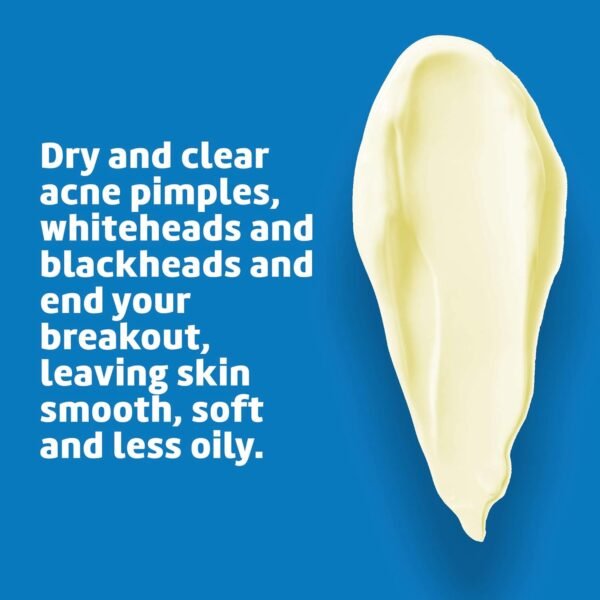 De La Cruz Sulfur Ointment - Cystic Acne Treatment for Face and Body - Daily 10 Min Spot Treatment Mask - Safe and Effective Game Changing Hormonal Acne Treatment that Clears Up Pimples - 2.6 OZ Tube - Image 5