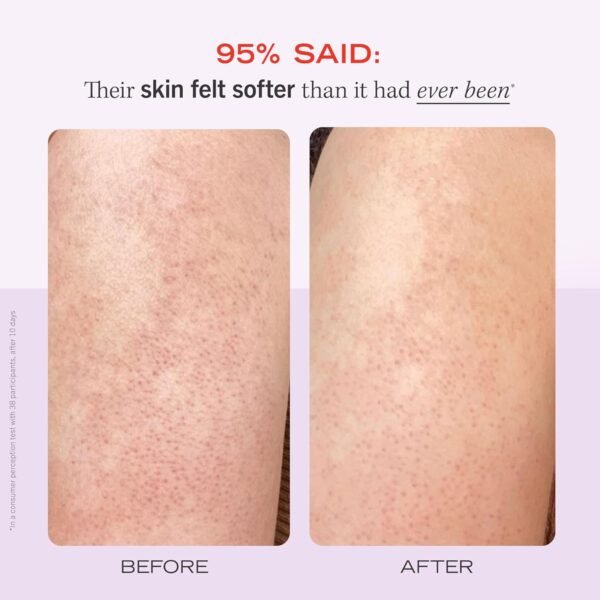 First Aid Beauty - KP Bump Eraser Body Scrub with 10% AHA, Keratosis Pilaris Exfoliater with Glycolic and Lactic acids, Helps Reduce Chicken Skin Bumps, Safe for Sensitive Skin, Strawberry Scent, 8 oz - Image 5