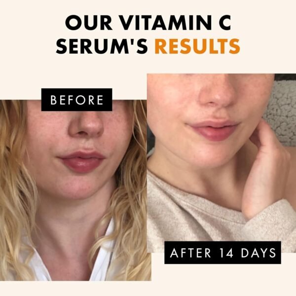 Vitamin C Face Serum - Dark Spot Remover Facial Serum, Vit C Serum with Hyaluronic Acid, Ferulic Acid, & Vit E - Anti Aging and Skin Brightening Serum, Pure Vitamin C Serum Skin Care 30 ml - Image 7