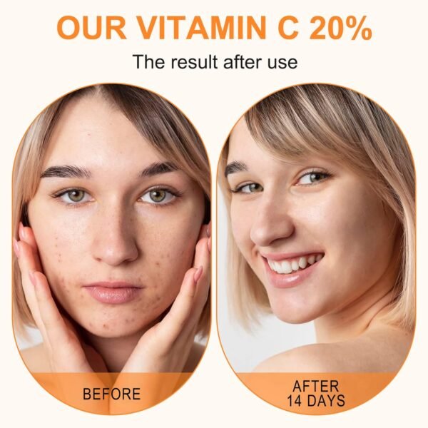 Premium 20% Vitamin C Serum For Face with Hyaluronic Acid, Retinol & Amino Acids - Boost Skin Collagen,Hydrate & Plump Skin, Anti Aging & Wrinkle Facial Serum 60ml - Image 6
