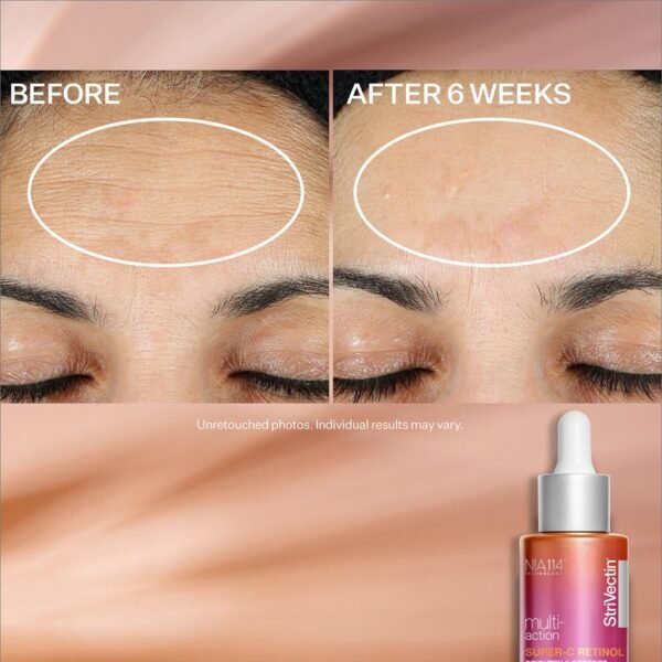 StriVectin Multi-Action Super-C Retinol Brighten and Correct Vitamin C Face Serum with Acerola Cherry Extract, 1 Fl Oz - Image 7
