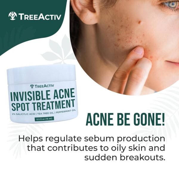 TreeActiv Invisible Salicylic Acid Cystic Acne Treatment For Face Original Formula, 0.5 fl oz, Acne Face Cream, Acne Spot Treatment for Face & Body, Acne Clearing Cream Moisturizer for Teens & Adults - Image 4