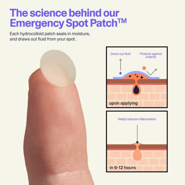 Curology Emergency Spot Pimple Patches for Face, Hydrocolloid Pimple Patches Fast-Acting Support, Spot Concealing and Oil Absorbing, 40 Count - Image 5