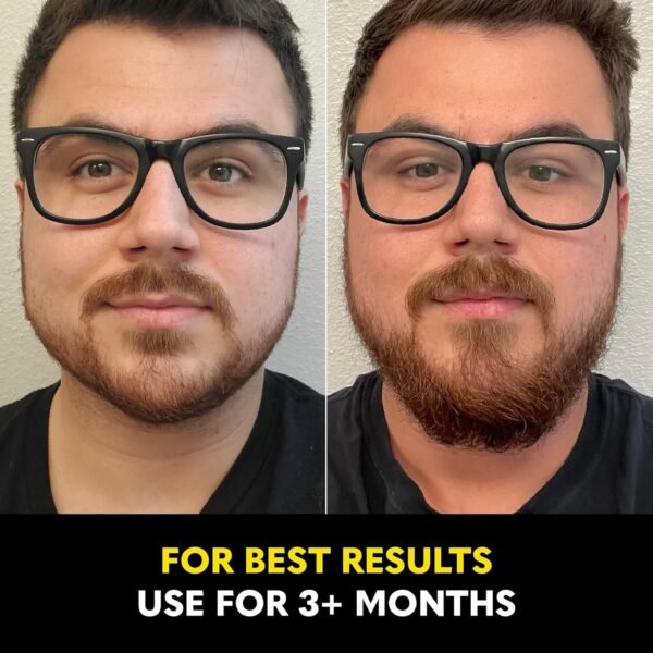 Beard Club - Beard Growth Serum with Natural Castor, Coconut and Avocado to Grow a Thicker, Fuller Beard, Fill in Patches and Stimulate Healthier Facial Hair Growth - Image 7