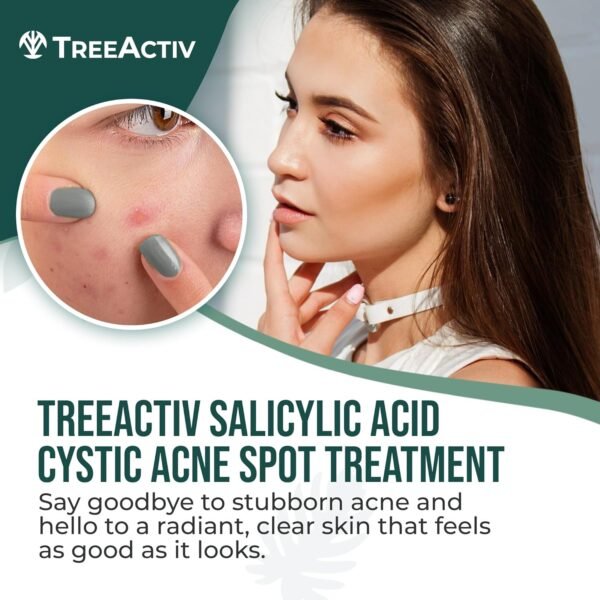 TreeActiv Salicylic Acid Cystic Acne Spot Treatment, 0.5 fl oz, Acne Treatment for Face, Acne Spot Cream, Hormonal Acne Treatment, Acne Spot Treatment for Face and Body, Acne Cream for Teens & Adults - Image 3
