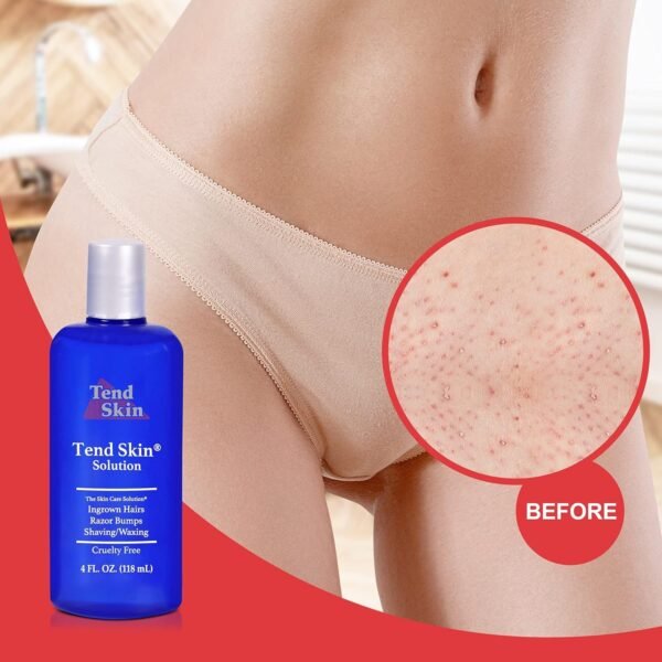 Tend Skin Womens AfterShave/Post Waxing Solution for Ingrown Hair, Razor Bumps and Burns, 4 ounce, Blue - Image 7