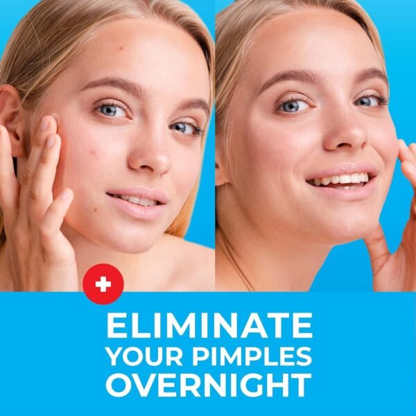 PatchRx Pimple Patches for Face (120 Patches), Hydrocolloid Acne Patches with Tea Tree Oil, Pimple Patch Pimple Stickers - Hydrocolloid Patch Acne Dots - Acne Pimple Patches For Face - Zit Patches - Image 3