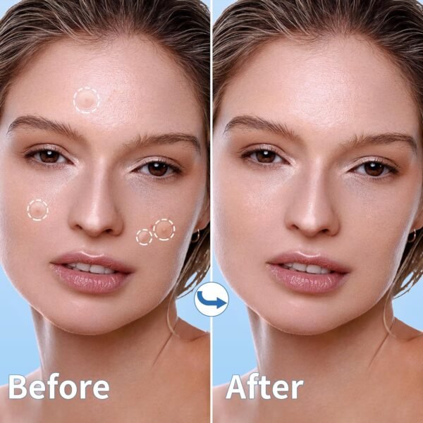 Pimple Patches for Face, 4 Size 300 Counts Acne Patches, Hydrocolloid Patches for Covering Zits and Blemishes, Spot Stickers with Salicylic Acid, Tea Tree Oil & Calendula Oil - Image 6
