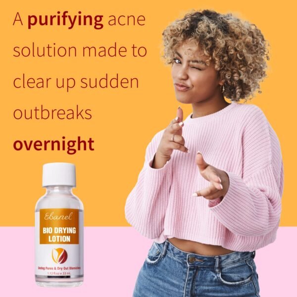 Ebanel Acne Drying Lotion, Overnight Salicylic Acid and Sulfur Cystic Acne Spot Treatment for Face and Body, Pimple Cream Spot Treatment, Dries Out Pimples, Cysts, Blemishes, Zits, and Clogged Pores - Image 5