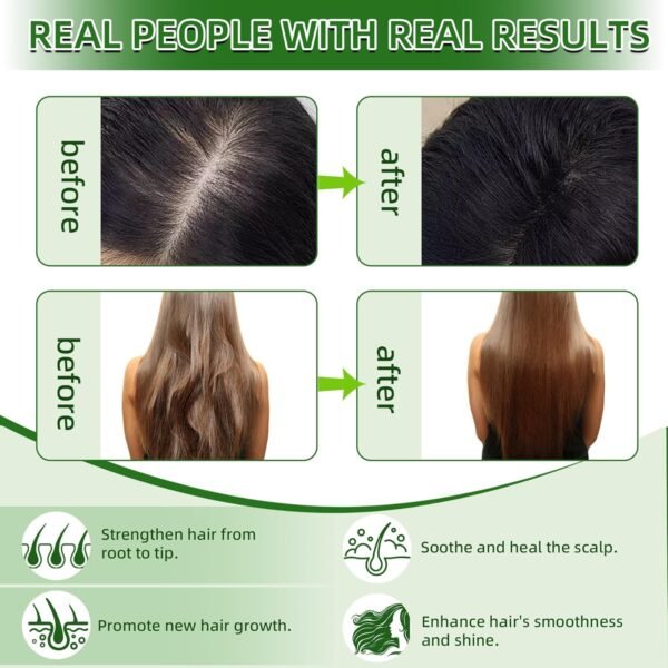 Batana Oil for Hair Growth, Batana Oil Organic 100%, Hair Growth Oil for Frizz, Split Ends, Texture & Shine (4.06 Fl oz, Original) - Image 6