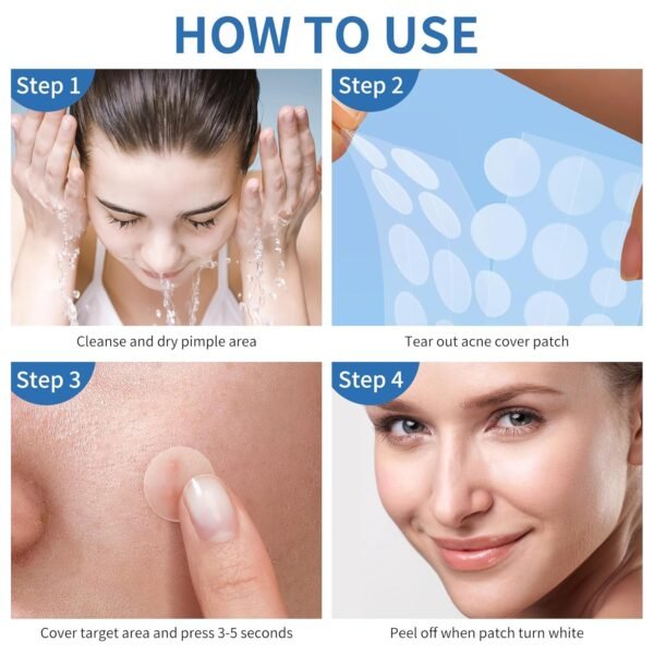 Pimple Patches for Face, 4 Size 300 Counts Acne Patches, Hydrocolloid Patches for Covering Zits and Blemishes, Spot Stickers with Salicylic Acid, Tea Tree Oil & Calendula Oil - Image 9