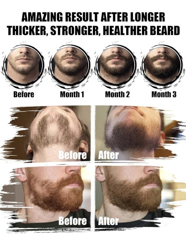 Beard Grooming Kit with 2 Pack Beard Original Oil, Beard Balm, Wash & Conditioner for After Shave Lotions-Sandalwood, Beard Brush, Combs, Valentine's Day Christmas Fathers Gifts for Dad or Men - Image 4