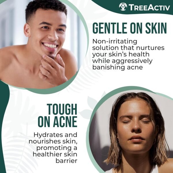 TreeActiv Salicylic Acid Cystic Acne Spot Treatment, 0.5 fl oz, Acne Treatment for Face, Acne Spot Cream, Hormonal Acne Treatment, Acne Spot Treatment for Face and Body, Acne Cream for Teens & Adults - Image 5