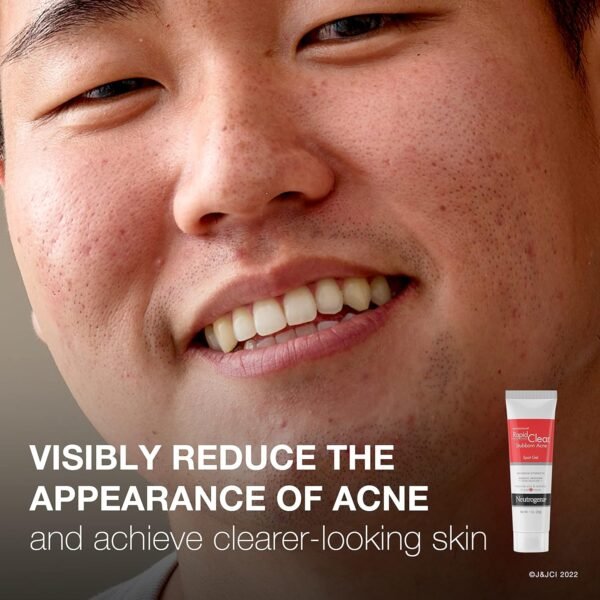 Neutrogena Rapid Clear Stubborn Acne Spot Treatment Gel with Maximum Strength 10% Benzoyl Peroxide Acne Treatment Medication, Pimple Cream for Acne Prone Skin Care, 1 oz - Image 4