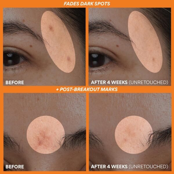 innisfree Green Tea Enzyme Vitamin C Brightening Serum for Dark Spot Fading, Korean Face Vitamin C Serum for Glow - Image 3