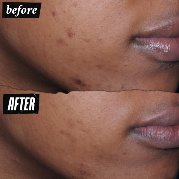 Kiehl's Better Screen UV Serum SPF 50+, Invisible Facial Sunscreen with Collagen Peptide, UV Filters to Shield UVA & UVB, Helps Correct Visible Signs of Aging, Boosts Skin Radiance - Image 6