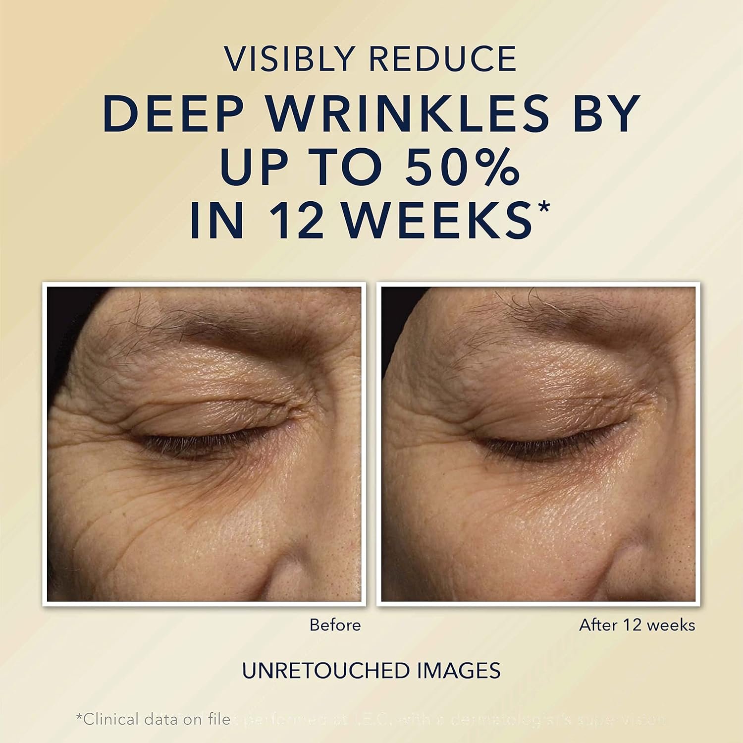 RoC Retinol Correxion Deep Wrinkle Anti-Aging Night Cream, Daily Face Moisturizer with Shea Butter, Glycolic Acid and Squalane, Stocking Stuffers for Men & Women, 1 Ounces (Packaging May Vary) - Image 5