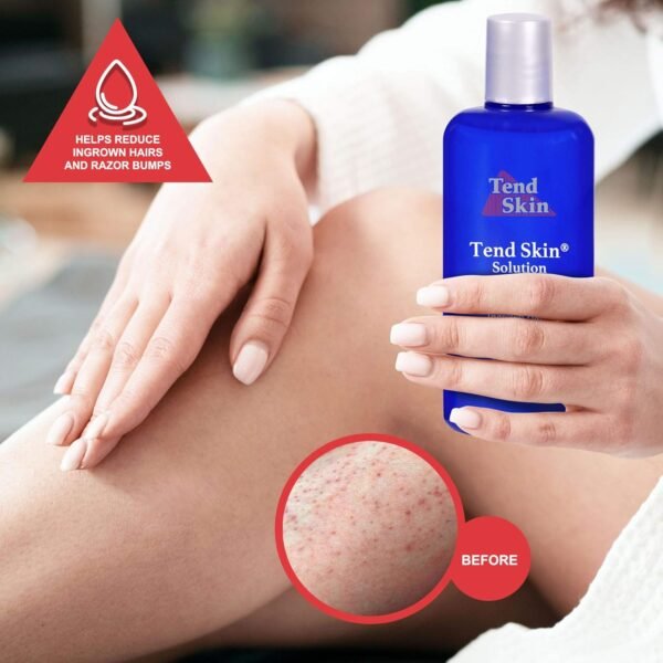 Tend Skin Womens AfterShave/Post Waxing Solution for Ingrown Hair, Razor Bumps and Burns, 4 ounce, Blue - Image 5