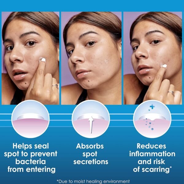 Clearasil Overnight Spot Patches, Advanced Healing Hydrocolloid Acne Pimple Treatment, Blemish Spot Stickers for Face, 18 count - Image 5