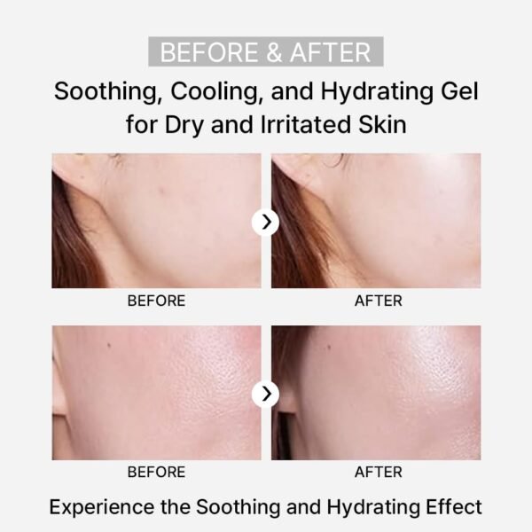 Rejuvenation Pflege Gel, Moisturizing Smoothing Cooling Gel Essence, Soothing Refreshing Non-Sticky Gel, Soothing and Hydrating Aloe Vera for Dry & Sensitive Skin - Image 9