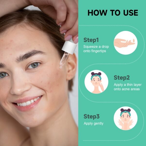 Acne Spot Treatment Serum for Face, with 2% Salicylic Acid & 4% Niacinamide Face Serum, Liquid Pimple Patch for Acne Prone Skin, Soothing Redness, Clearing Oil Skin Care for Teens & Adults - Image 4