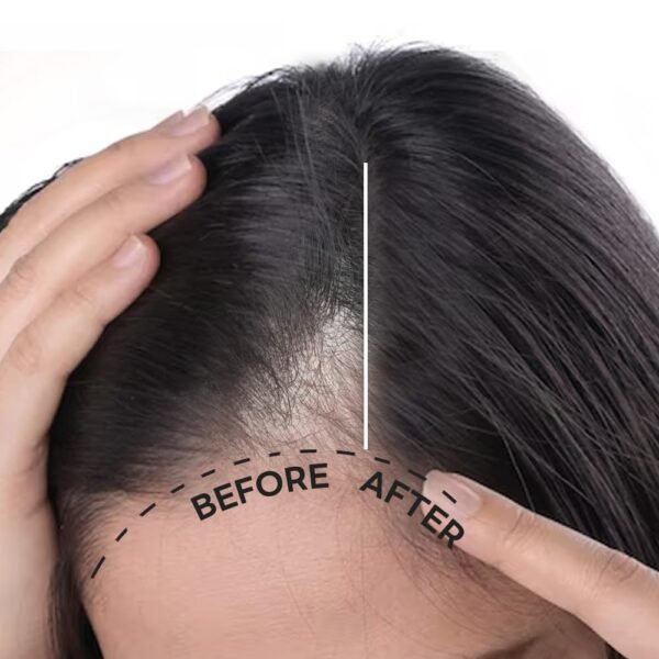 Soybean & Biotin Shampoo for hair growth｜korean shampoo for thinning hair, Dandruff Control, Oily Roots, Hair loss, Volume Boost and Strengthening & Repair (13.52 fl oz) - Image 4