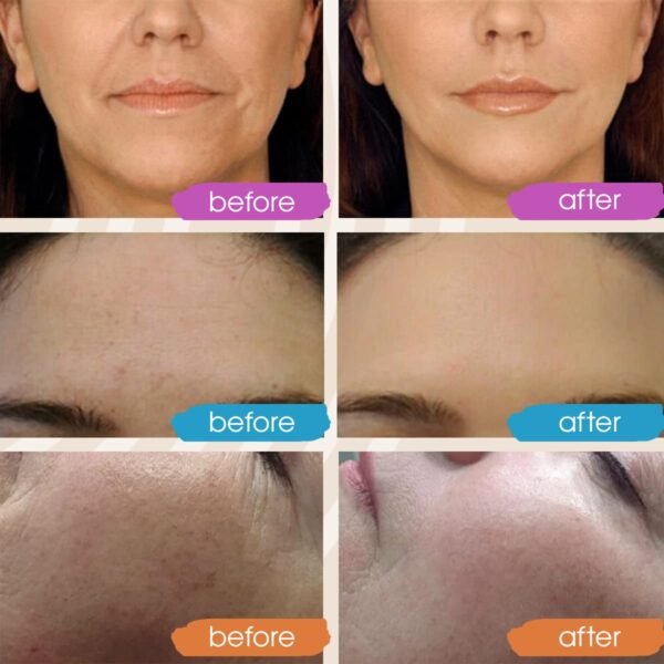 Vitamin C Face Serum, Hydrating Vitamin C Serum for Face with Hyaluronic Acid, Suitable For All Skin Types, Targets the Appearance of Dull Spots 2oz - Image 4