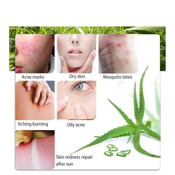 ROADCREW Aloe Vera gel 300 ML Natural AloeVera Gel -Organic Moisturizing Cream, Soothing and Hydrating, Sunburn and Scar Repair, Care for Face Body Hair - Image 5