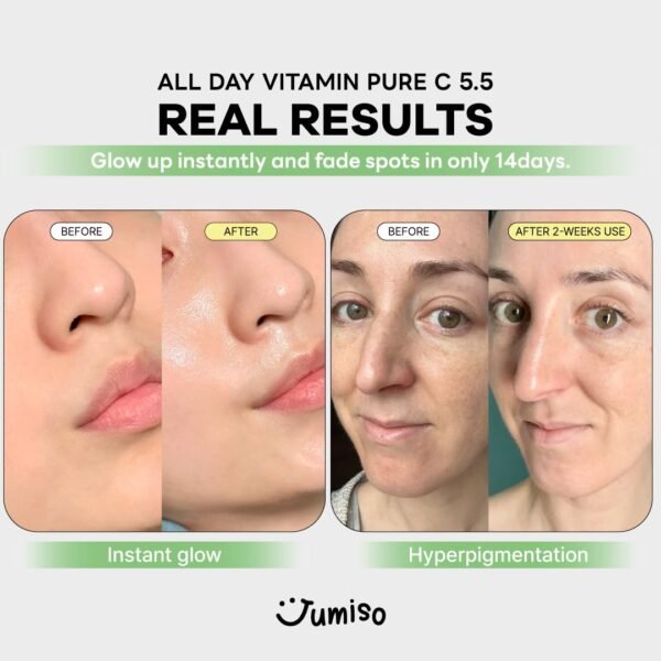 All Day Pure C 5.5 Glow Serum 30ml | Aronia Fruit Extract | Pure Vitamin C (L-Ascorbic Acid) with Alpha-Arbutin&Ascorbyl Glucoside | fragrance-free, parabens-free | 1.01 fl oz, 30 ml - Image 7