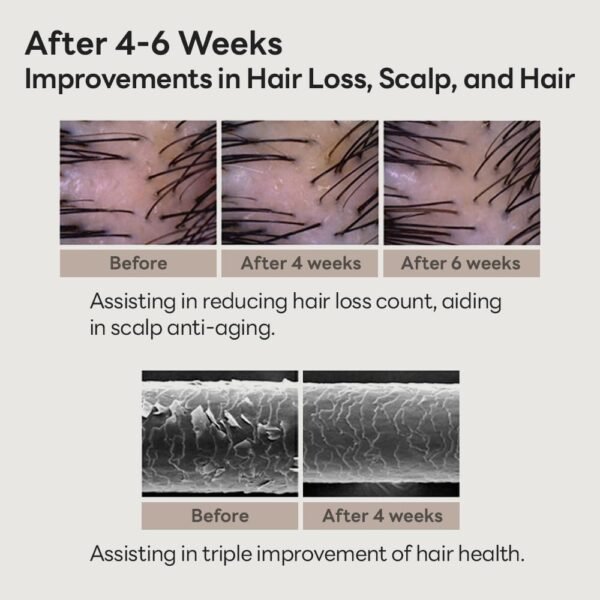 Soybean & Biotin Shampoo for hair growth｜korean shampoo for thinning hair, Dandruff Control, Oily Roots, Hair loss, Volume Boost and Strengthening & Repair (13.52 fl oz) - Image 5