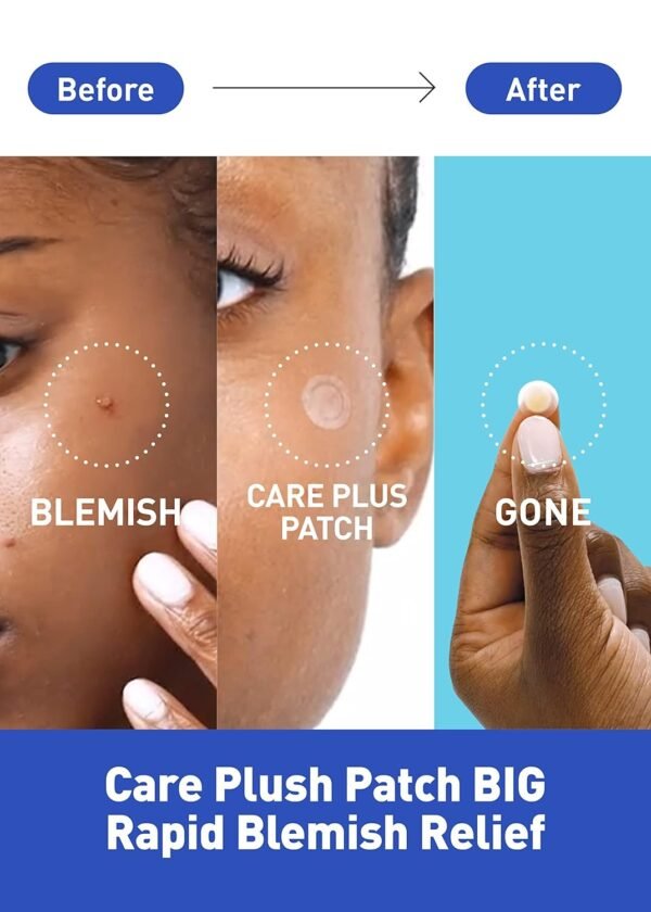 OLIVE YOUNG Care Plus Spot Patch 1 Pack | Hydrocolloid Acne Korean Spot Patch to Cover Zits, Pimples and Blemishes, for Troubled Skin and Face (102 Count - 10mm*72ea + 12mm*30ea) - Image 3