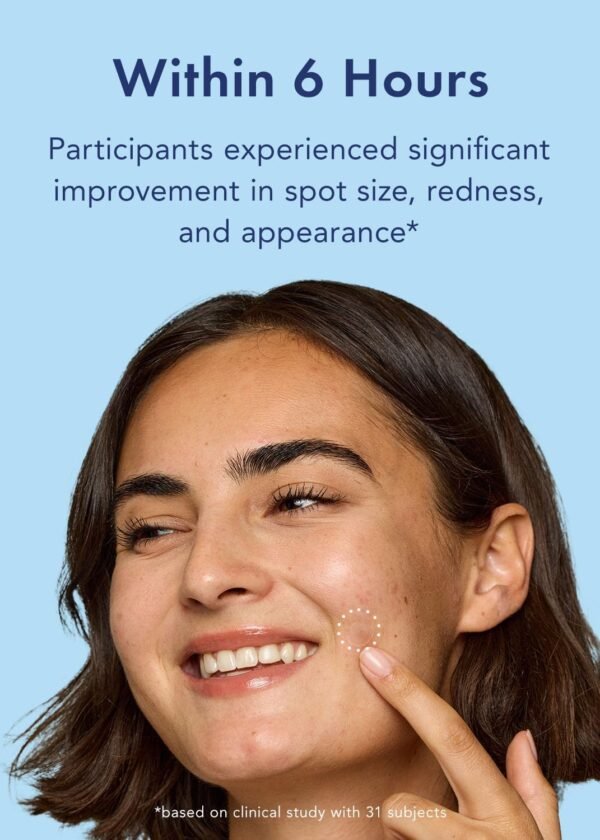 Rael Pimple Patches, Miracle Retinol Spot Cover - Hydrocolloid Acne Patch for Face, Absorbing Zits & Blemishes, PM Advanced Treatment, Facial Sticker (72 Count) - Image 6