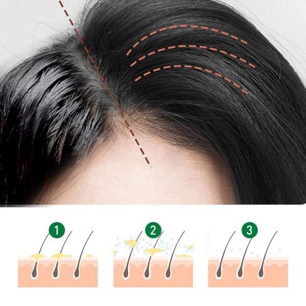Moutew Hair, Moutew Hair Leave-In Volumizing Styling, High Cranial Fluffing, No-Wash Fluffy Hair, Long-Lasting Oil-Control Volume Non-Sticky Hair for Women Men (2pcs) - Image 6