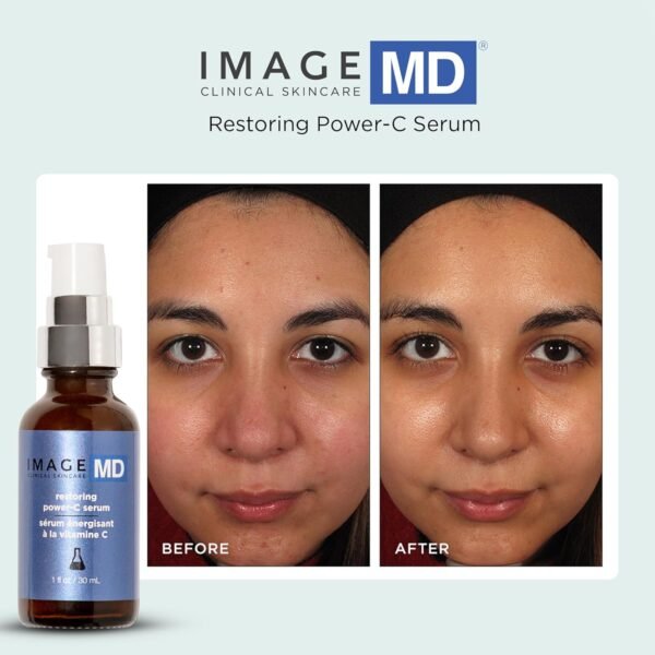IMAGE Skincare, IMAGE MD Restoring Power-C Serum, 20% Vitamin C, Ferulic Acid Facial Serum to Reduce Pigmentation, Firm, Brighten Skin - Image 8
