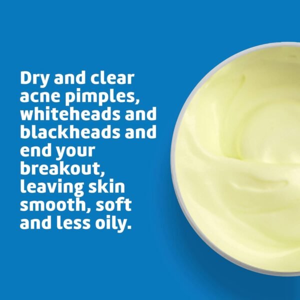 De La Cruz 10% Sulfur Ointment - Cystic Acne Treatment for Face and Body - Daily 10 Min Spot Treatment Mask - Safe and Effective Game Changing Hormonal Acne Treatment That Clears Up Pimples - 2.6 oz - Image 5