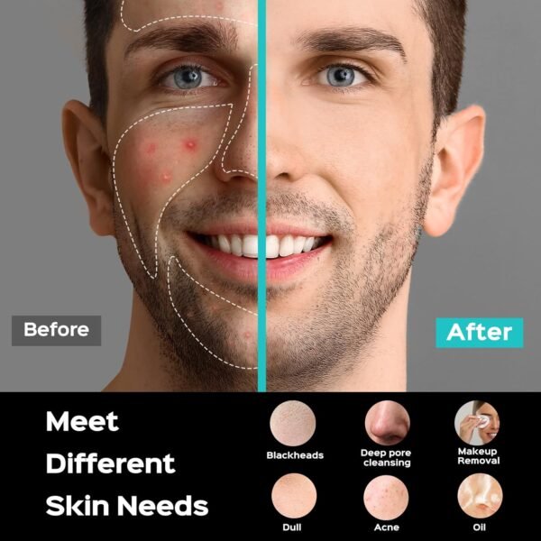 Face Scrubber Facial Cleansing Brush : COSLUS Portable Silicone Waterproof Rechargeable Face Wash Brush, 5 Cleansing Modes, Electric Deep Cleaning for Men & Women, Removing Blackhead, Exfoliating - Image 8