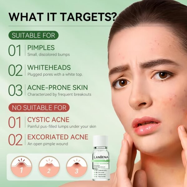 LANBENA Precision Acne Spot Serum, Acne Drying Lotion, Overnight Acne Treatment For Face, Dry Out Pimples, Blemishes, Zits And Clean Pores, 0.42 Fl Oz - Image 5