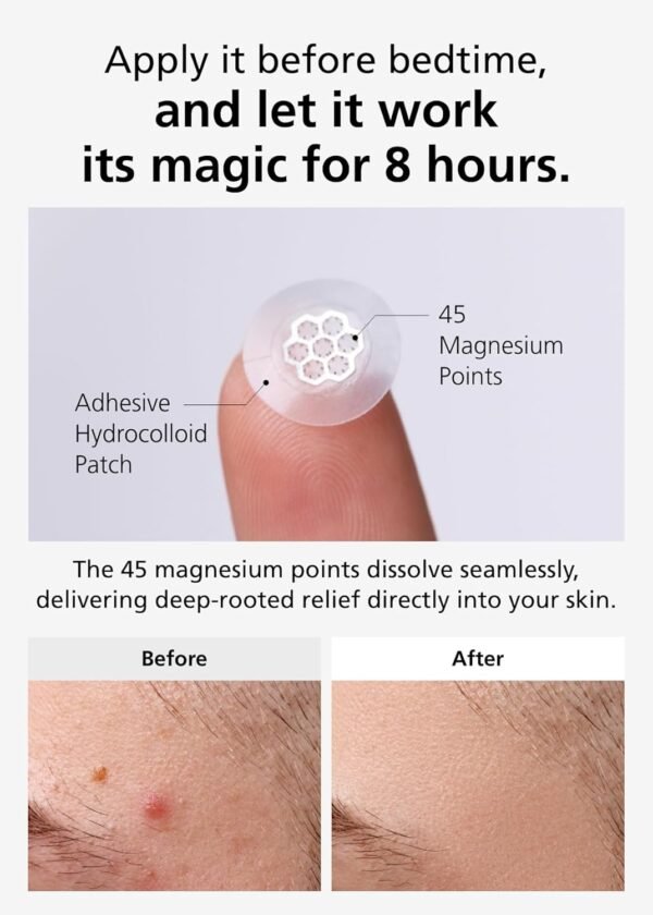 EasyDerm Quick Calming Magnesium Patches – Hydrocolloid Acne Spot Treatment with Tea Tree & Cica, 10 Patches, Zit Sticker, TikTok Viral Blemish Patch - Image 8